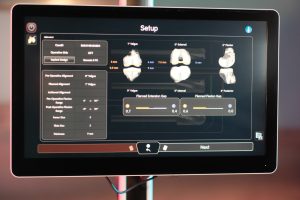 Pentingnya Persiapan Mental dan Fisik sebelum Jalani Robotic Total Knee Replacement
