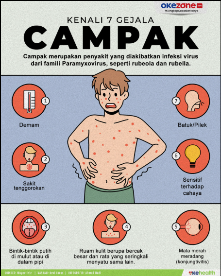 Campak Merebak, Berbahayakah? Ayo bersama cegah Wabah Campak